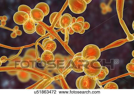 Computer illustration of the unicellular fungus (yeast) Candida auris. C. auris was first identified in 2009. It causes serious multidrug-resistant infections in hospitalized patients and has high mortality rates. It causes bloodstream, wound and ear... View Large Photo Image Stock Image - Computer illustration of the unicellular fungus (yeast) Candida auris. C. auris was first identified in 2009. It causes serious multidrug-resistant infections in hospitalized patients and has high mortality rates. It causes bloodstream, wound and ear.... Fotosearch