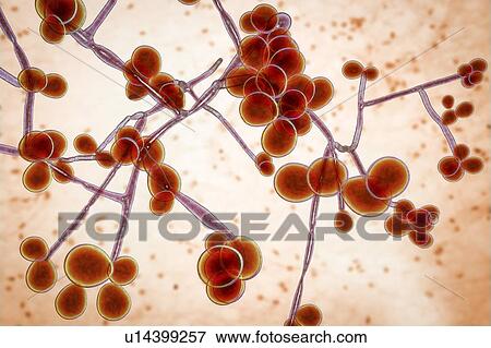 Computer illustration of the yeast and hyphae stages of Candida albicans. A yeast-like fungus commonly occurring on human skin, in the upper respiratory, alimentary and female genital tracts. This fungus has a dimorphic life cycle with yeast and... View Large Photo Image Stock Photo - Computer illustration of the yeast and hyphae stages of Candida albicans. A yeast-like fungus commonly occurring on human skin, in the upper respiratory, alimentary and female genital tracts. This fungus has a dimorphic life cycle with yeast and.... Fotosearch