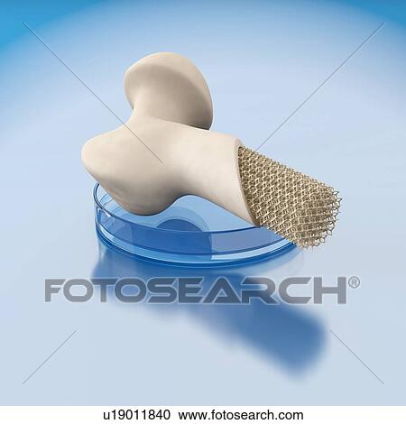 Stock Image - Concept of bioprinting of human bone. Part of the artificial tibia ready for transplantation to the patient. 3D illustration.. Fotosearch