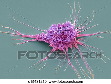 Dendritic cell. Coloured scanning electron micrograph (SEM) of a protective cell of the human immune system known as a dendritic cell. The long projections seen on the cell's surface are feet to help it move. These cells process foreign antigens which... View Large Photo Image Stock Image - Dendritic cell. Coloured scanning electron micrograph (SEM) of a protective cell of the human immune system known as a dendritic cell. The long projections seen on the cell's surface are feet to help it move. These cells process foreign antigens which.... Fotosearch