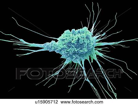 Dendritic cell. Coloured scanning electron micrograph (SEM) of a protective cell of the human immune system known as a dendritic cell. The long projections seen on the cell's surface are feet to help it move. These cells process foreign antigens which... View Large Photo Image Stock Image - Dendritic cell. Coloured scanning electron micrograph (SEM) of a protective cell of the human immune system known as a dendritic cell. The long projections seen on the cell's surface are feet to help it move. These cells process foreign antigens which.... Fotosearch