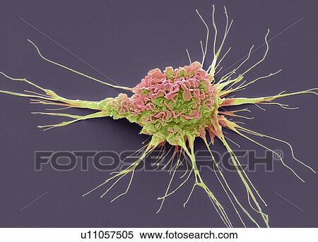 Stock Photography - Dendritic cell. Coloured scanning electron micrograph (SEM) of a protective cell of the human immune system known as a dendritic cell. The long projections seen on the cell's surface are feet to help it move. These cells process foreign antigens which.... Fotosearch