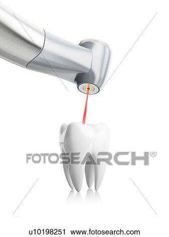 Stock Image - Dental treatment, conceptual illustration.. Fotosearch