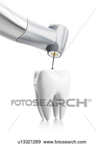 Dental treatment, conceptual illustration. View Large Photo Image Stock Photo - Dental treatment, conceptual illustration.. Fotosearch