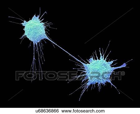 Stock Photograph - Dividing prostate cancer cells, coloured scanning electron micrograph (SEM). Such cells can clump to form tumours, which often invade and destroy surrounding tissues. The prostate is a small gland found in men just below the bladder, surrounding the.... Fotosearch