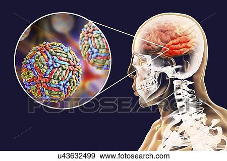 Encephalitis caused by West Nile virus, computer illustration. West Nile virus (WNV) is known to cause encephalitis (inflammation of the brain) in humans. The WNV belongs to the flavivirus group, which are RNA (ribonucleic acid) viruses that are... View Large Photo Image Stock Photo - Encephalitis caused by West Nile virus, computer illustration. West Nile virus (WNV) is known to cause encephalitis (inflammation of the brain) in humans. The WNV belongs to the flavivirus group, which are RNA (ribonucleic acid) viruses that are.... Fotosearch