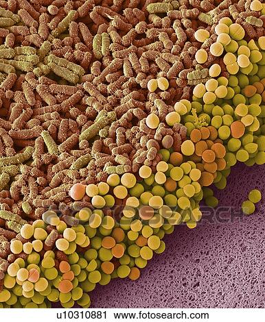 Stock Image - Faecal bacteria. Scanning electron micrograph (SEM) of bacteria cultured from a sample of human faeces. At least 50 per cent of human faeces is made up of bacteria shed from the gut. Many of these bacteria are a normal part of the flora found in the.... Fotosearch