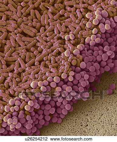Faecal bacteria. Scanning electron micrograph (SEM) of bacteria cultured from a sample of human faeces. At least 50 per cent of human faeces is made up of bacteria shed from the gut. Many of these bacteria are a normal part of the flora found in the... View Large Photo Image Stock Image - Faecal bacteria. Scanning electron micrograph (SEM) of bacteria cultured from a sample of human faeces. At least 50 per cent of human faeces is made up of bacteria shed from the gut. Many of these bacteria are a normal part of the flora found in the.... Fotosearch