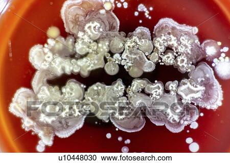 Stock Image - Fungus growing on agar.. Fotosearch
