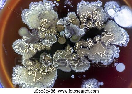 Stock Photograph - Fungus growing on agar.. Fotosearch