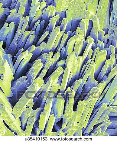 Gallstone crystals. Coloured scanning electron micrograph (SEM) of the crystalline surface of a fractured gallstone. Gallstones form in the gallbladder when there is an imbalance in the chemical composition of the bile. Gallstones mostly consist of... View Large Photo Image Stock Image - Gallstone crystals. Coloured scanning electron micrograph (SEM) of the crystalline surface of a fractured gallstone. Gallstones form in the gallbladder when there is an imbalance in the chemical composition of the bile. Gallstones mostly consist of.... Fotosearch