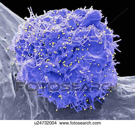 HIV infected cell. Coloured scanning electron micrograph (SEM) of a 293T cell infected with the human immunodeficiency virus (HIV, yellow dots). Small spherical virus particles, visible on the surface, are in the process of budding from the cell... View Large Photo Image Picture - HIV infected cell. Coloured scanning electron micrograph (SEM) of a 293T cell infected with the human immunodeficiency virus (HIV, yellow dots). Small spherical virus particles, visible on the surface, are in the process of budding from the cell.... Fotosearch