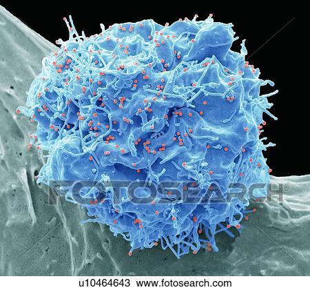 HIV infected cell. Coloured scanning electron micrograph (SEM) of a 293T cell infected with the human immunodeficiency virus (HIV, red dots). Small spherical virus particles, visible on the surface, are in the process of budding from the cell... View Large Photo Image Stock Image - HIV infected cell. Coloured scanning electron micrograph (SEM) of a 293T cell infected with the human immunodeficiency virus (HIV, red dots). Small spherical virus particles, visible on the surface, are in the process of budding from the cell.... Fotosearch