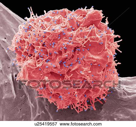 Stock Photo - HIV infected cell. Coloured scanning electron micrograph (SEM) of a 293T cell infected with the human immunodeficiency virus (HIV, blue dots). Small spherical virus particles, visible on the surface, are in the process of budding from the cell.... Fotosearch