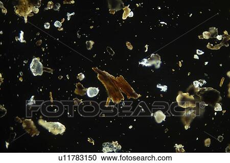 House dust, light micrograph. View Large Photo Image Stock Image - House dust, light micrograph.. Fotosearch