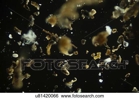 Stock Photograph - House dust, light micrograph.. Fotosearch
