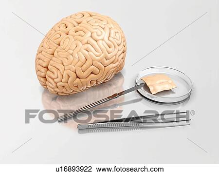 Stock Image - Human brain and surgical instruments on a laboratory table. 3d illustration.. Fotosearch