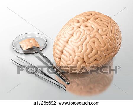 Stock Image - Human brain and surgical instruments on a laboratory table. 3d illustration.. Fotosearch