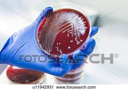 Laboratory assistant examining growth on a petri dish, close up. View Large Photo Image Stock Image - Laboratory assistant examining growth on a petri dish, close up.. Fotosearch