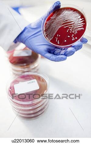 Stock Image - Laboratory assistant examining growth on a petri dish, close up.. Fotosearch