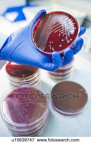 Laboratory assistant examining growth on a petri dish, close up. View Large Photo Image Stock Photo - Laboratory assistant examining growth on a petri dish, close up.. Fotosearch