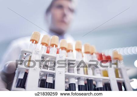 Laboratory assistant holding medical samples in rack. View Large Photo Image Stock Photo - Laboratory assistant holding medical samples in rack.. Fotosearch