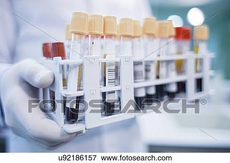 Laboratory assistant holding medical samples in rack, close up. View Large Photo Image Stock Photo - Laboratory assistant holding medical samples in rack, close up.. Fotosearch