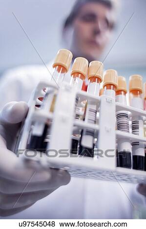 Stock Photo - Laboratory assistant holding medical samples in rack.. Fotosearch
