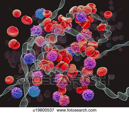 Stock Photo - Leukaemia, conceptual composite image. Scanning electron microscopy (SEM) and computer generated image (CGI) of DNA (deoxyribonucleic acid) molecules (helices) and red and white blood cells. Leukaemia is cancer of the white blood cells. Leukemias are.... Fotosearch