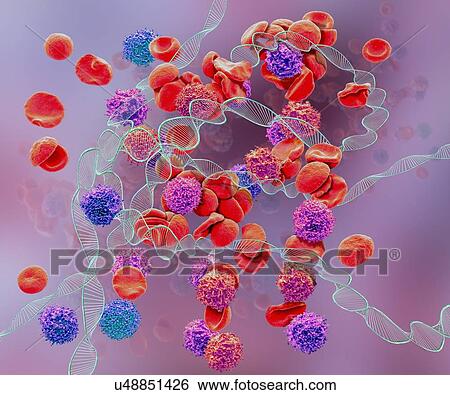 Stock Photograph - Leukaemia, conceptual composite image. Scanning electron microscopy (SEM) and computer generated image (CGI) of DNA (deoxyribonucleic acid) molecules (helices) and red and white blood cells. Leukaemia is cancer of the white blood cells. Leukemias are.... Fotosearch
