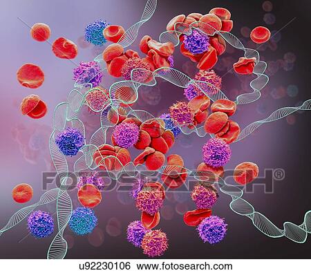 Leukaemia, conceptual composite image. Scanning electron microscopy (SEM) and computer generated image (CGI) of DNA (deoxyribonucleic acid) molecules (helices) and red and white blood cells. Leukaemia is cancer of the white blood cells. Leukemias are... View Large Photo Image Stock Photograph - Leukaemia, conceptual composite image. Scanning electron microscopy (SEM) and computer generated image (CGI) of DNA (deoxyribonucleic acid) molecules (helices) and red and white blood cells. Leukaemia is cancer of the white blood cells. Leukemias are.... Fotosearch