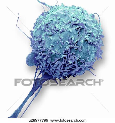 Stock Photo - Macrophage. Coloured scanning electron micrograph (SEM) of a macrophage white blood cell. Macrophages are cells of the body's immune system. They are found in the tissues rather than in the circulating blood. Macrophages recognise foreign particles,.... Fotosearch