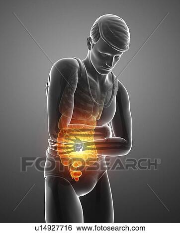 Stock Photograph - Man with abdominal pain, computer illustration.. Fotosearch