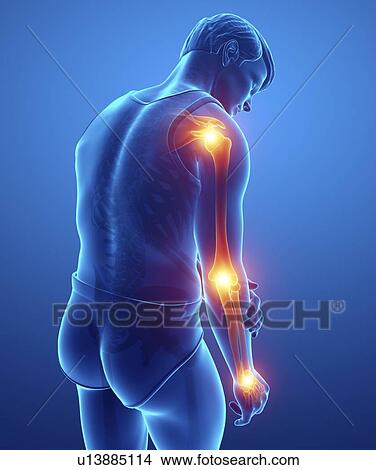Man with arm pain, computer illustration. View Large Photo Image Picture - Man with arm pain, computer illustration.. Fotosearch