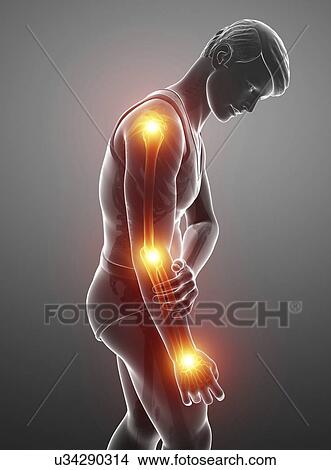 Picture - Man with arm pain, computer illustration.. Fotosearch
