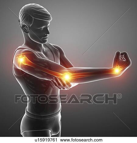 Man with arm pain, computer illustration. View Large Photo Image Stock Image - Man with arm pain, computer illustration.. Fotosearch