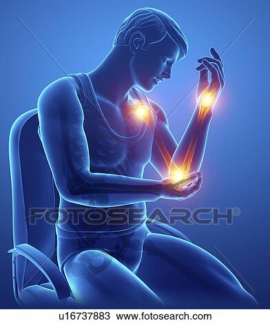 Stock Image - Man with arm pain, computer illustration.. Fotosearch