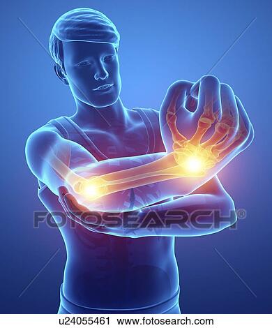 Man with arm pain, computer illustration. View Large Photo Image Stock Image - Man with arm pain, computer illustration.. Fotosearch