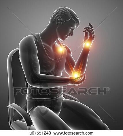 Stock Image - Man with arm pain, computer illustration.. Fotosearch