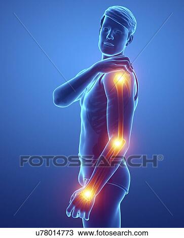 Man with arm pain, computer illustration. View Large Photo Image Stock Image - Man with arm pain, computer illustration.. Fotosearch