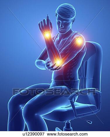 Man with arm pain, computer illustration. View Large Photo Image Stock Photo - Man with arm pain, computer illustration.. Fotosearch