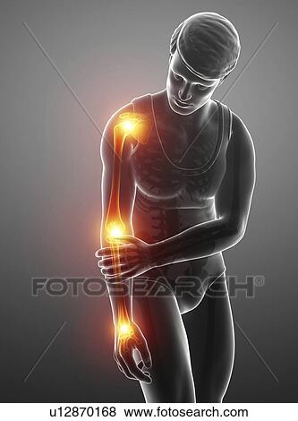 Man with arm pain, computer illustration. View Large Photo Image Stock Photo - Man with arm pain, computer illustration.. Fotosearch