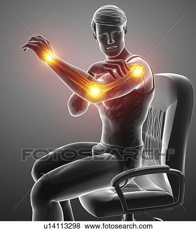 Stock Photo - Man with arm pain, computer illustration.. Fotosearch