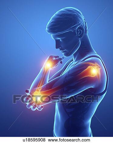 Man with arm pain, computer illustration. View Large Photo Image Stock Photo - Man with arm pain, computer illustration.. Fotosearch