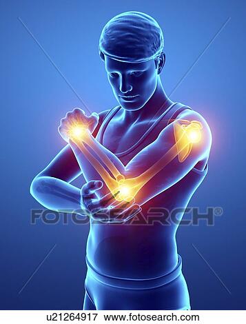 Man with arm pain, computer illustration. View Large Photo Image Stock Photo - Man with arm pain, computer illustration.. Fotosearch