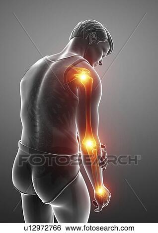 Man with arm pain, computer illustration. View Large Photo Image Stock Photograph - Man with arm pain, computer illustration.. Fotosearch