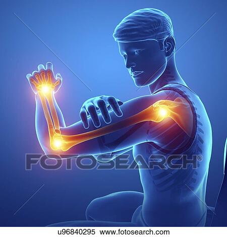 Man with arm pain, computer illustration. View Large Photo Image Stock Photography - Man with arm pain, computer illustration.. Fotosearch