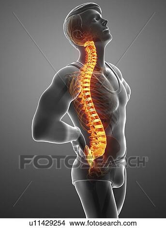Picture - Man with back pain, computer illustration.. Fotosearch