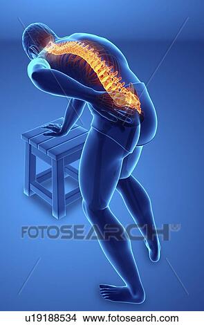 Man with back pain, computer illustration. View Large Photo Image Picture - Man with back pain, computer illustration.. Fotosearch