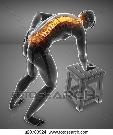 Man with back pain, computer illustration. View Large Photo Image Picture - Man with back pain, computer illustration.. Fotosearch